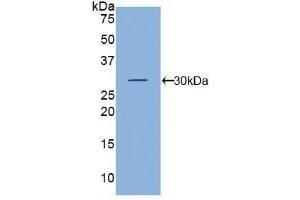 Detection of Recombinant KLK5, Mouse using Polyclonal Antibody to Kallikrein 5 (KLK5) (Kallikrein 5 Antikörper  (AA 25-261))