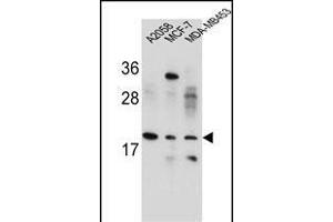 VCX1/VCX2/VCX3 Antibody (N-term) (ABIN654781 and ABIN2844462) western blot analysis in ,MCF-7,MDA-M cell line lysates (35 μg/lane). (VCX Antikörper  (N-Term))