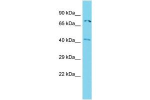 Host: Rabbit Target Name: ACTR8 Sample Type: Jurkat Whole Cell lysates Antibody Dilution: 1. (ACTR8 Antikörper  (N-Term))