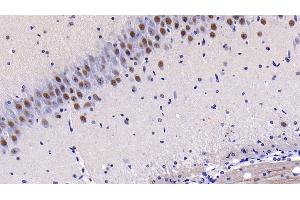 Immunohistochemistry (IHC) image for anti-Mitogen-Activated Protein Kinase Kinase 4 (MAP2K4) (AA 137-394) antibody (ABIN7439399)