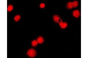 Immunofluorescent analysis of MSH6 staining in HeLa cells. (MSH6 Antikörper  (Center))