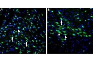 Expression of LRRK2 in rat striatum and substantia nigra - Immunohistochemical staining of perfusion-fixed frozen rat brain sections using Anti-LRRK2 Antibody (ABIN7044716 and ABIN7044717), (1:400), followed by goat-anti-rabbit-AlexaFluor-488 secondary antibody. (LRRK2 Antikörper  (N-Term))