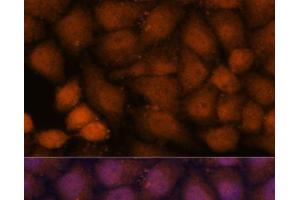 Immunofluorescence analysis of HeLa cells using CEP85 Polyclonal Antibody at dilution of 1:100. (CEP85 Antikörper)