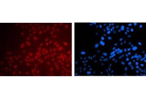 Immunofluorescence Microscopy of Mouse anti-PAX6 antibody. (PAX6 Antikörper)