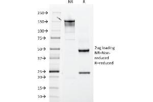 SDS-PAGE Analysis Purified CD61 Mouse Monoclonal Antibody (ITGB3/2145). (Integrin beta 3 Antikörper  (AA 385-490))