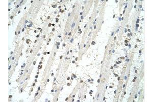 TRIM32 antibody was used for immunohistochemistry at a concentration of 4-8 ug/ml. (TRIM32 Antikörper  (C-Term))