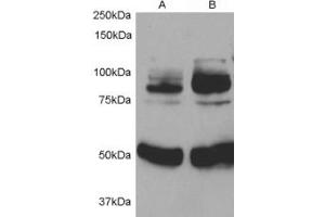 Western Blotting (WB) image for anti-Adaptor Protein, phosphotyrosine Interaction, PH Domain and Leucine Zipper Containing 1 (APPL1) (Internal Region) antibody (ABIN2465417) (APPL1 Antikörper  (Internal Region))