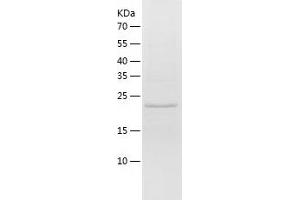 Western Blotting (WB) image for Regulator of G-Protein Signaling 2 (RGS2) (AA 1-211) protein (His tag) (ABIN7124816) (RGS2 Protein (AA 1-211) (His tag))
