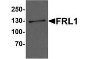 Western blot analysis of FRL1 in EL4 cell lysate with FRL1 Antibody  at 1 μg/ml. (Formin-Like 1 Antikörper  (C-Term))