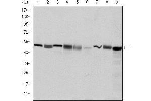 Western blot analysis using CCT2 mouse mAb against Hela (1), MCF-7 (2), Jurkat (3), T47D (4), K562 (5), A431 (6), NIH/3T3 (7), PC-12 (8) and Cos7 (9) cell lysate. (CCT2 Antikörper)