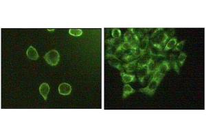 Immunofluorescence staining of methanol-fixed A431 (left) and Hela (right) cells showing cytoplasmic and membrane localization.