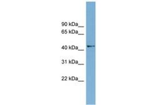 AMDHD1 Antikörper  (AA 35-84)