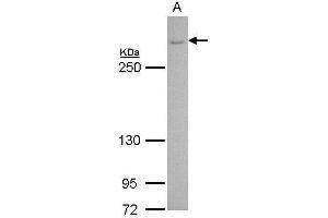 WB Image CACNA1B antibody [C3], C-term detects CACNA1B protein by Western blot analysis.