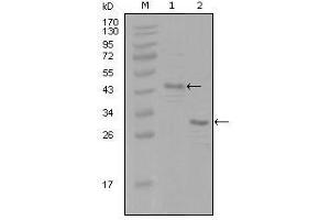 Western Blot showing ESR1 antibody used against truncated Trx-ESR1 recombinant protein (1) and truncated ESR1 (aa130-339)-His recombinant protein (2). (Estrogen Receptor alpha Antikörper  (AA 130-339))