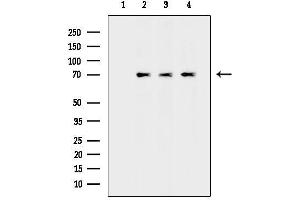 anti-Down Syndrome Critical Region Gene 3 (DSCR3) antibody