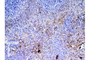 IHC analysis of PF4 using anti-PF4 antibody . (PF4 Antikörper  (AA 30-105))