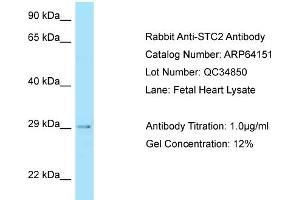 Western Blotting (WB) image for anti-Stanniocalcin 2 (STC2) (C-Term) antibody (ABIN2789750) (Stanniocalcin 2 Antikörper  (C-Term))