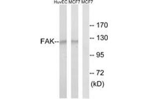 Western blot analysis of extracts from MCF-7/HuvEc cells, using FAK (Ab-843) Antibody. (FAK Antikörper  (AA 809-858))