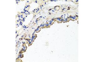Immunohistochemistry of paraffin-embedded rat lung using TUBB8 antibody. (Tubulin, beta 8 Antikörper)