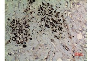 Immunohistochemistry (IHC) analysis of paraffin-embedded Human Breast, antibody was diluted at 1:100. (APEX1 Antikörper  (acLys6))