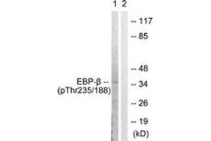 Western blot analysis of extracts from HepG2 cells treated with EGF 200ng/ml 30', using C/EBP-beta (Phospho-Thr235/188) Antibody. (CEBPB Antikörper  (pThr235))