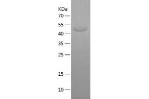 Kv2.1/KCNB1 Protein (AA 640-858) (His-IF2DI Tag)