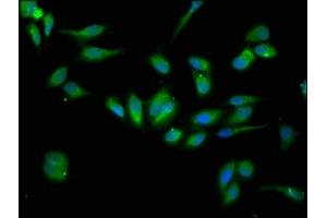 Immunofluorescence staining of Hela cells with ABIN7151703 at 1:133, counter-stained with DAPI. (HSP9B1 (AA 27-799) Antikörper)