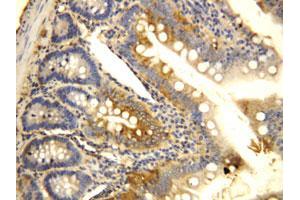 Immunohistochemical staining of CCR6 on formalin fixed, paraffin embedded rat intestine with CCR6 polyclonal antibody . (CCR6 Antikörper  (N-Term))
