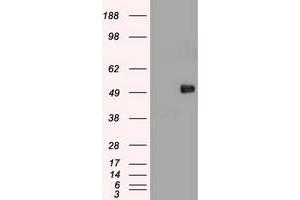 Image no. 11 for anti-Myc Proto-Oncogene protein (MYC) antibody (ABIN1497013) (c-MYC Antikörper)