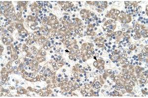 Immunohistochemical staining (Formalin-fixed paraffin-embedded sections) of human liver with KYNU polyclonal antibody .