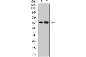 Western Blotting (WB) image for anti-Deoxynucleotidyltransferase, terminal (DNTT) (AA 52-192) antibody (ABIN5907278)
