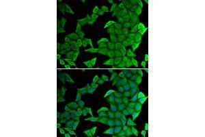 Immunofluorescence analysis of U2OS cells using SMYD2 antibody (ABIN6130910, ABIN6148167, ABIN6148168 and ABIN6222133).