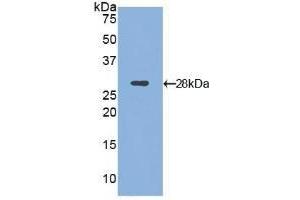Detection of Recombinant ITGaD, Mouse using Polyclonal Antibody to Integrin Alpha D (ITGaD) (ITGAD Antikörper  (AA 886-1106))