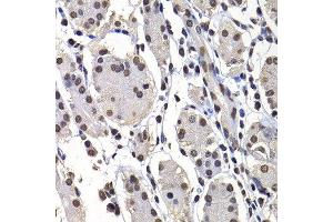 Immunohistochemistry of paraffin-embedded human stomach using H2AFY antibody at dilution of 1:100 (x400 lens). (H2AFY Antikörper)