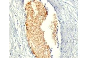 Formalin-fixed, paraffin-embedded human placenta stained with AMPD3 antibody (AMPD3/901) (AMPD3 Antikörper)