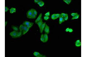 Immunofluorescence staining of HepG2 cells with ABIN7149534 at 1:400, counter-stained with DAPI. (Nitrilase 1 Antikörper  (AA 1-243))