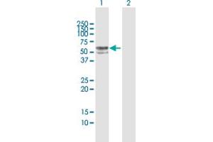 Western Blotting (WB) image for anti-Fucosidase, alpha-L- 1, Tissue (FUCA1) (AA 1-461) antibody (ABIN949998)