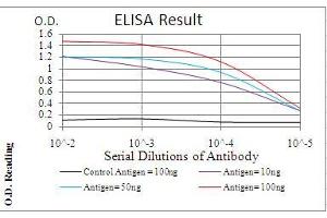 Black line: Control Antigen (100 ng), Purple line: Antigen(10 ng), Blue line: Antigen (50 ng), Red line: Antigen (100 ng), (PDPK1 Antikörper  (AA 457-556))