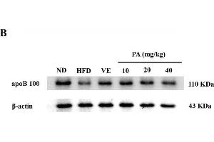 PA treatment attenuated HFD-induced apoB 100 reduction in rats. (APOB Antikörper  (AA 28-330))