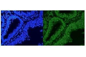IF analysis of HnRNP A1 using anti-HnRNP A1 antibody (ABIN4886621). (HNRNPA1 Antikörper  (N-Term))