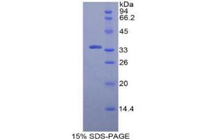 SDS-PAGE analysis of Rat MPG Protein. (MPG Protein)