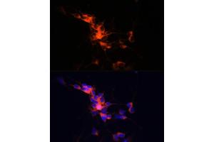 Immunofluorescence analysis of SH-SY5Y cells using βIII-Tubulin/β3-Tubulin Rabbit mAb (ABIN7271049) at dilution of 1:100 (40x lens). (TUBB3 Antikörper)