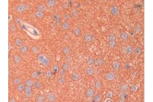 Detection of SPTAN1 in Rat Cerebrum Tissue using Polyclonal Antibody to Alpha-Fodrin (SPTAN1) (SPTAN1 Antikörper  (AA 2071-2269))