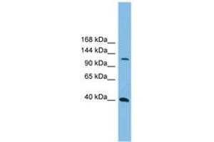 Image no. 1 for anti-Mitogen-Activated Protein Kinase Kinase Kinase 14 (MAP3K14) (AA 71-120) antibody (ABIN6744716) (MAP3K14 Antikörper  (AA 71-120))