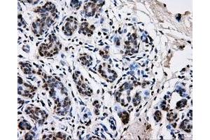 Immunohistochemical staining of paraffin-embedded breast tissue using anti-PKMYT1 mouse monoclonal antibody. (PKMYT1 Antikörper)
