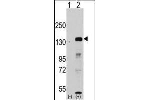 Western blot analysis of JHDM1a/FBXL11 (arrow) using rabbit polyclonal JHDM1a/FBXL11 Antibody (Center) (ABIN387896 and ABIN2844142). (KDM2A Antikörper  (AA 500-527))