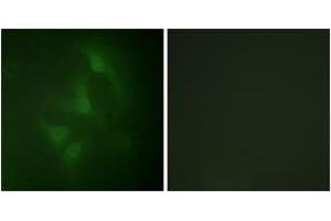 Immunofluorescence analysis of HeLa cells, using JNK1/2/3 (Ab-183/185) Antibody. (JNK Antikörper  (AA 151-200))