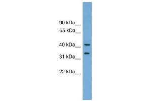 FAM118A antibody used at 1 ug/ml to detect target protein. (FAM118A Antikörper  (Middle Region))