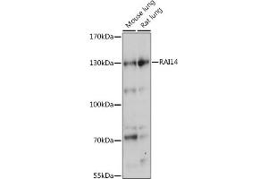 Western blot analysis of extracts of various cell lines, using R antibody (ABIN7269945) at 1:1000 dilution. (RAI14 Antikörper  (AA 300-600))