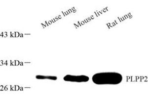 Western blot analysis of PLPP2 (ABIN7075037),at dilution of 1: 1500